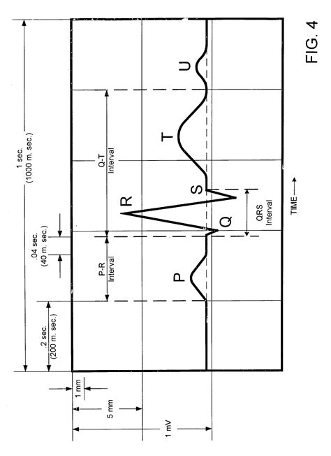 Unlabeled Wiggers Diagram
