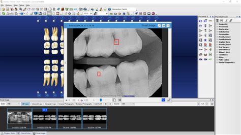 Image result for Dentrix Help