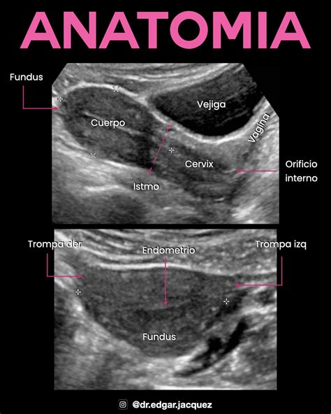 Dr Edgar Jacquez | 🩺 Ultrasonido Uterino El ultrasonido uterino es una ...