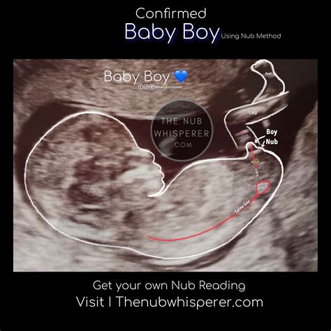 Baby boy 💙 Nub Theory | Gender prediction, Baby gender prediction ...