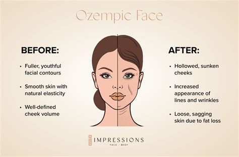 How to Fix Ozempic Face | Impressions Face + Body | Chicago