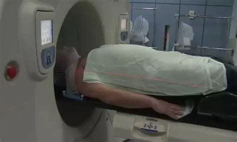 Head and neck radiation therapy tied to dental caries and subsequent ...