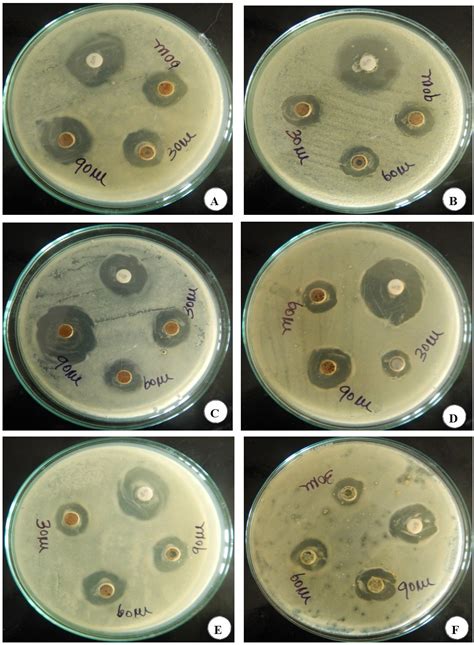Antimicrobial and anticancer activities of ethanol and methanol ...