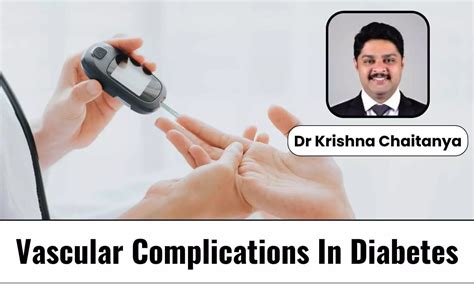 What is the Connection between Diabetes and Vascular Disease? How to ...
