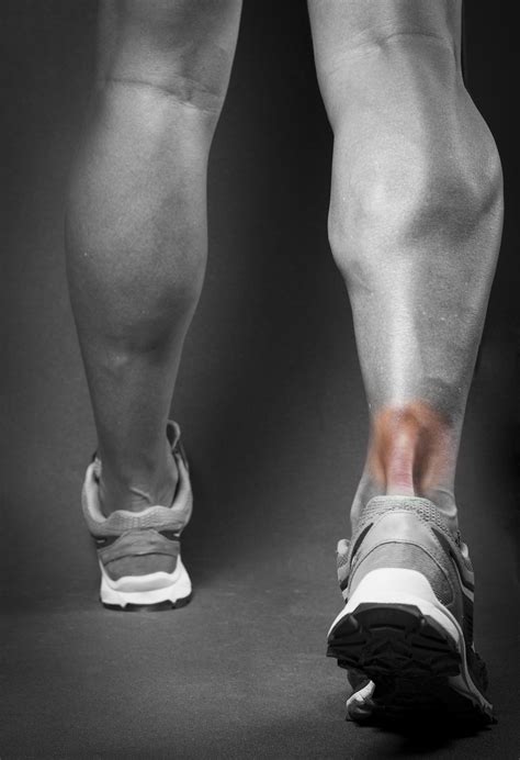 Runners Injuries Achilles Tendonitis at Alan Darlington blog