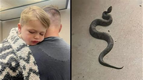 Tennessee child survives copperhead bite | Here's what to do if it ...