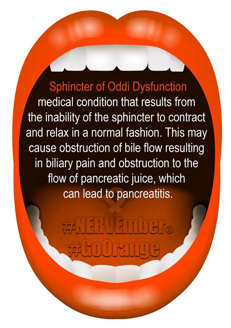 Sphincter of Oddi Dysfunction - iPain Foundation Conditions Information - what triggers sphincter of oddi pain