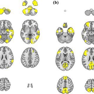 Image result for EEG Source Localization