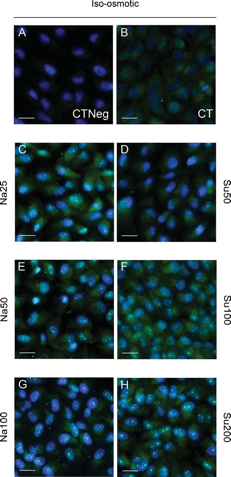 Image result for Scale Bar Magnification