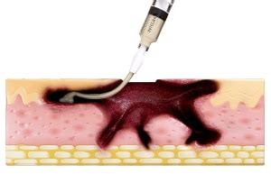 Image result for Micro Matrix Flex