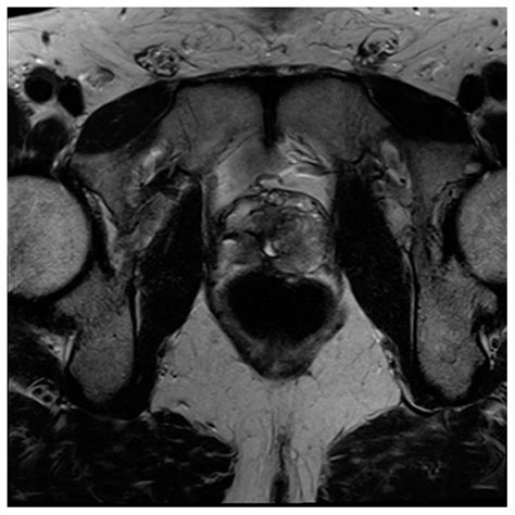Contemporary Review of Multimodality Imaging of the Prostate Gland