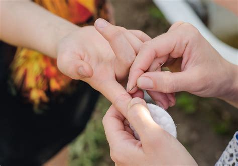 Image result for Hair Splinter Infection