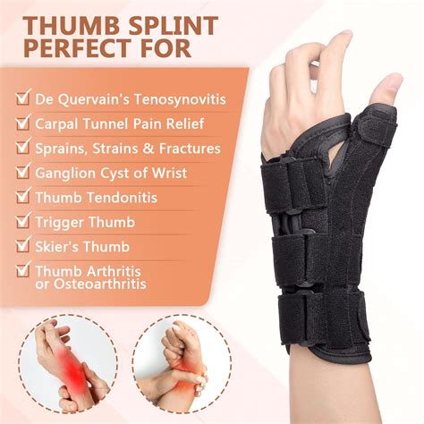 De Quervain's Vs Trigger Finger at Ana Means blog