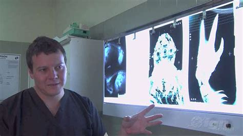 Exoskeletons Explained