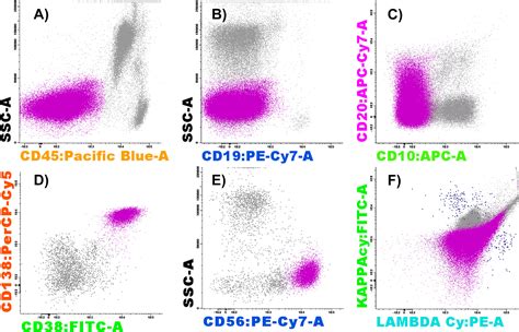 A rare finding of plasma cell leukaemia with hairy-cell morphology - Pathology