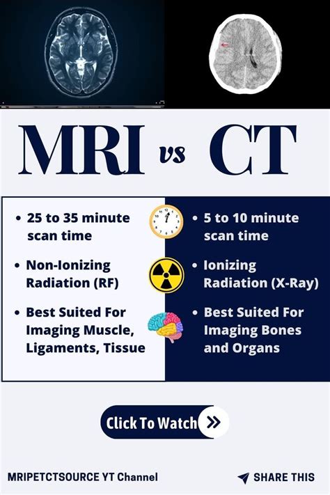 Image result for MRI Vs CT Scan