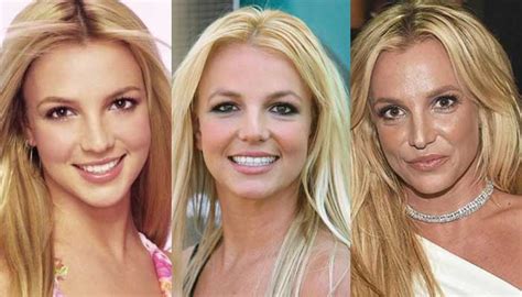 Britney Spears Plastic Surgery Before and After Pictures 2023