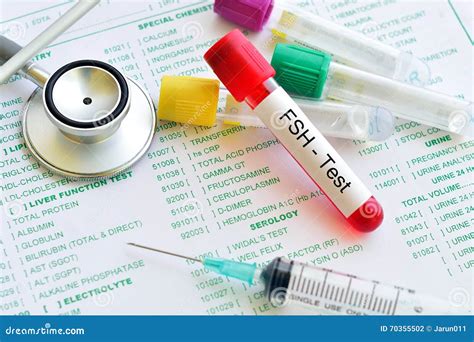FSH test stock photo. Image of exam, fertilize, uterus - 70355502