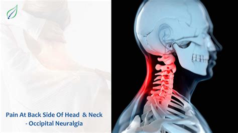 Understanding Occipital Neuralgia: Causes & Relief | Best Back Pain, Slip Disc, Knee Arthritis ...