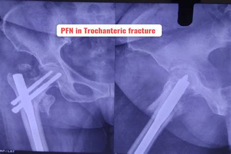 Dr. Sumit Mahajan, Gandhi Nagar, Jammu, Joint Replacement, Knee ...