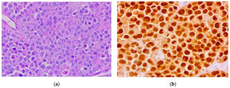 Actualities in the Morphology and Immunohistochemistry of Cutaneous and ...