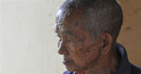 The man who body is growing old too fast is helping us find a way to ...