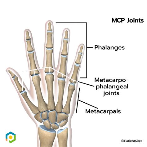 What Type Of Joint Is Metacarpophalangeal Joint