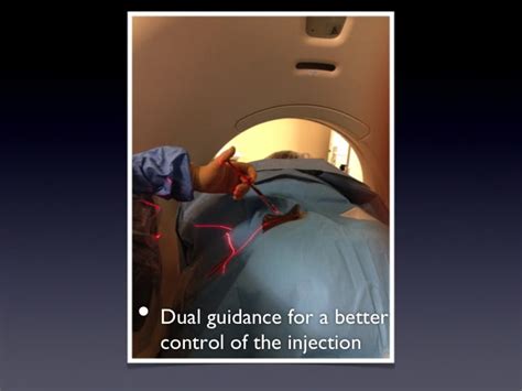 Image result for Disco Injection