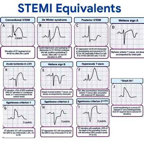 Dr. Morphine⚕️ | STEMI.. #heart #ecg #ekg #ecginterpretation # ...