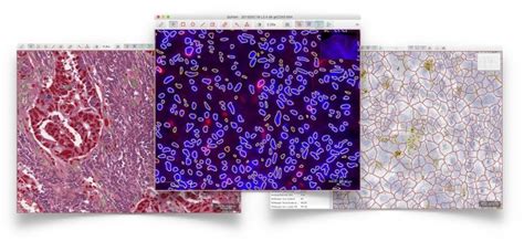 QuPath Tutorial 的图像结果