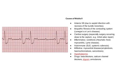 Ecg presentation | PDF