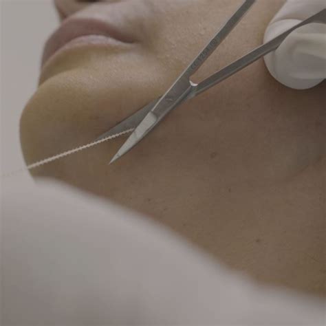 Thread Procedure 的图像结果