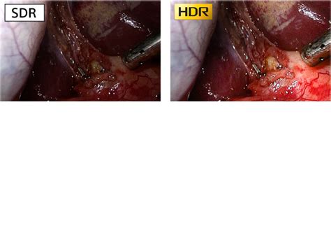 An image showing the difference between SDR and HDR quality