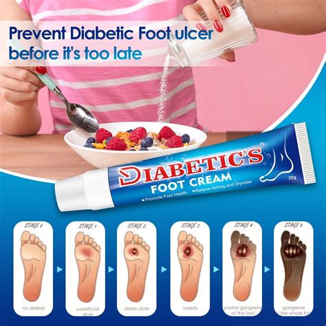Buy Diabetic's Foot Cream Itchy Foot Care Ointment Improve Skin ...