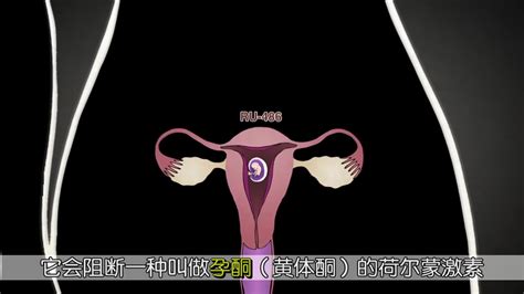 反堕胎科普片 全4集_哔哩哔哩 (゜-゜)つロ 干杯~-bilibili