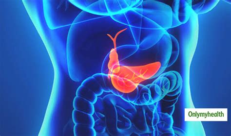 Dr K N Srivastava Talks About The Causes And Risk Factors Of Gall ...