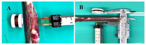 Polymeric Orthosis with Electromagnetic Stimulator Controlled by Mobile ...