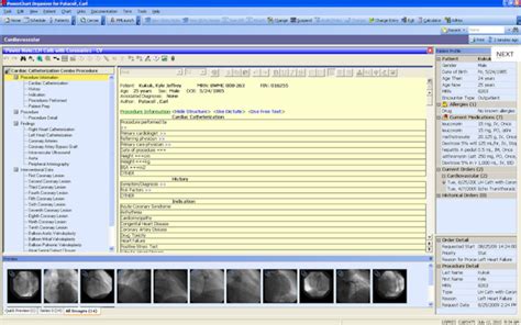 PowerChart 的图像结果