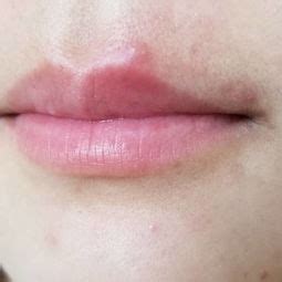 嘴唇周围皮肤暗沉怎么处理呢？是什么原因造成的？ - 知乎