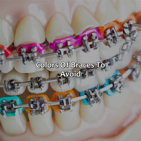 What Color Braces Make Your Teeth Look Whiter - colorscombo.com