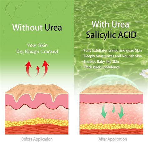 Vebuni Intensive Urea Foot Cream with Salicylic Acid - 42% India | Ubuy