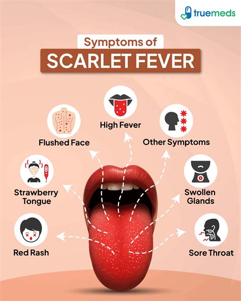 Scarlet Fever: Symptoms, Causes, Treatment & Prevention Guide