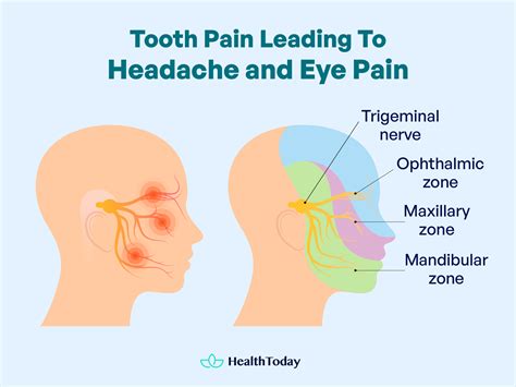 Toothache Causing Headache and Eye Pain | Hidden Links