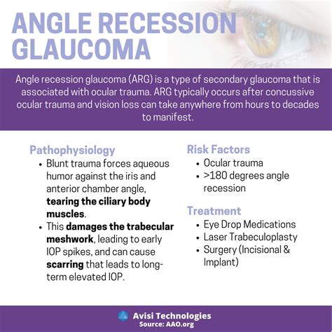 Angle Recession 的图像结果