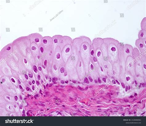 Transitional Epithelium Urothelium Exclusive Urinary Tract Stock Photo 2128486961 | Shutterstock