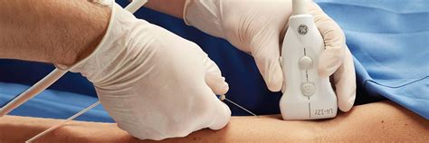 Point of Care Ultrasound Machines | GE Healthcare (India)