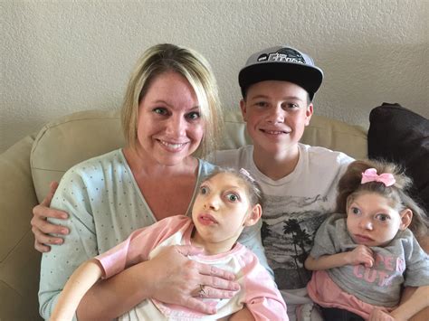 My Daughters Were Born With Microcephaly - Zika Virus and Pregnancy