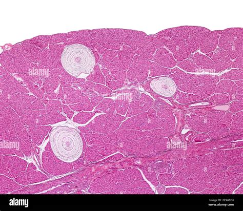 Pacinian corpuscle microscope hi-res stock photography and images - Alamy