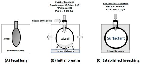 The Respiratory Management of the Extreme Preterm in the Delivery Room