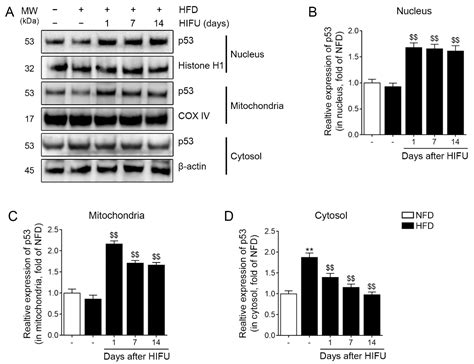 High-Intensity Focused Ultrasound Decreases Subcutaneous Fat Tissue Thickness by Increasing ...